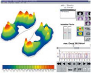MediLogic Computerauswertung - Fußdruckmessung